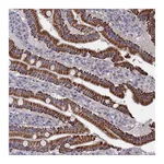 Atlas Antibodies Anti-ZNF891 Antibody