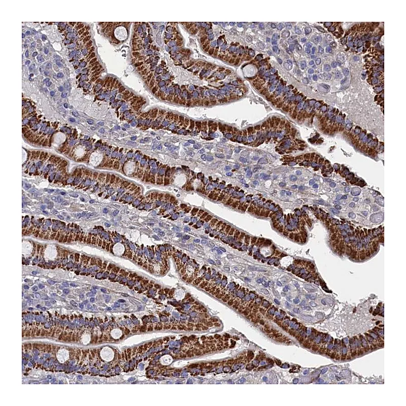 Atlas Antibodies Anti-ZNF891 Antibody