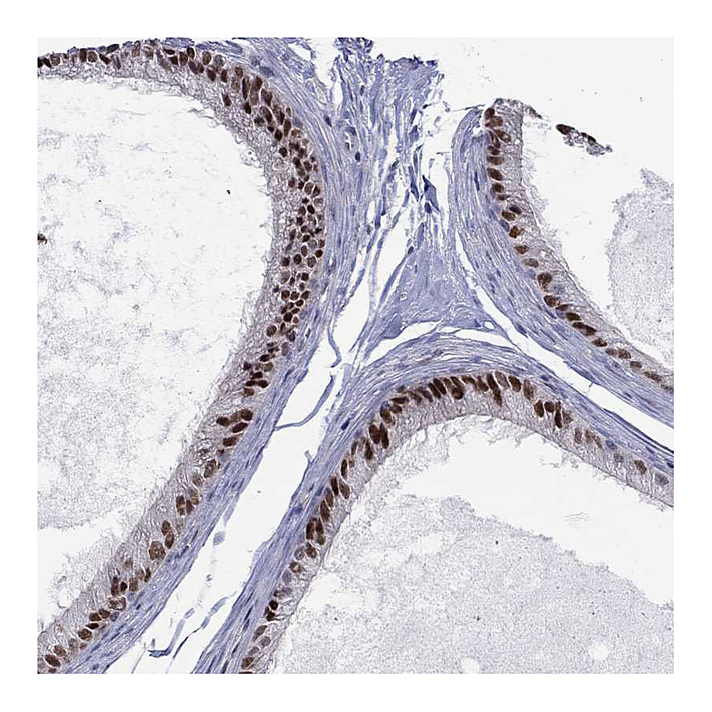 Atlas Antibodies Anti-ZNHIT3 Antibody