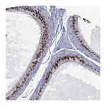 Atlas Antibodies Anti-ZNHIT3 Antibody