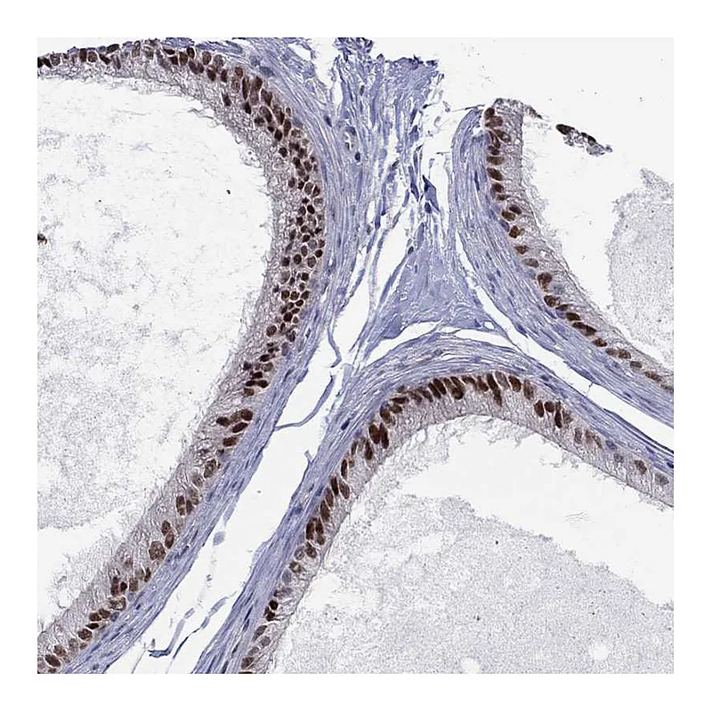Atlas Antibodies Anti-ZNHIT3 Antibody
