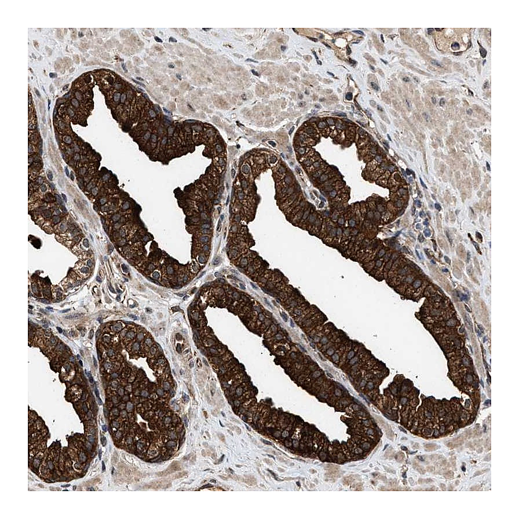 Atlas Antibodies Anti-ZNHIT6 Antibody