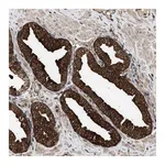 Atlas Antibodies Anti-ZNHIT6 Antibody