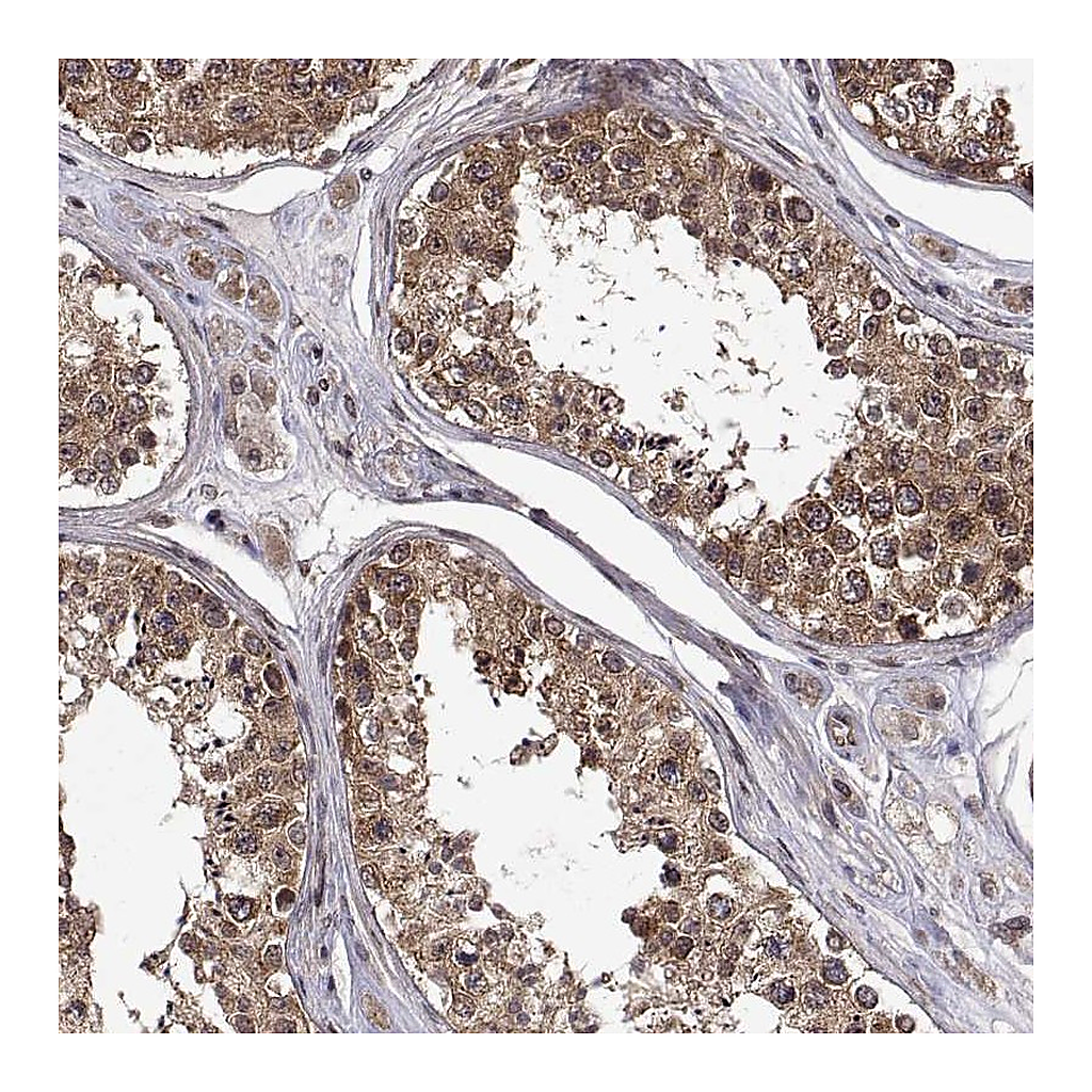 Atlas Antibodies Anti-ZNRF2 Antibody