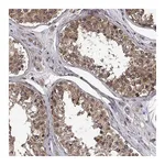 Atlas Antibodies Anti-ZNRF2 Antibody