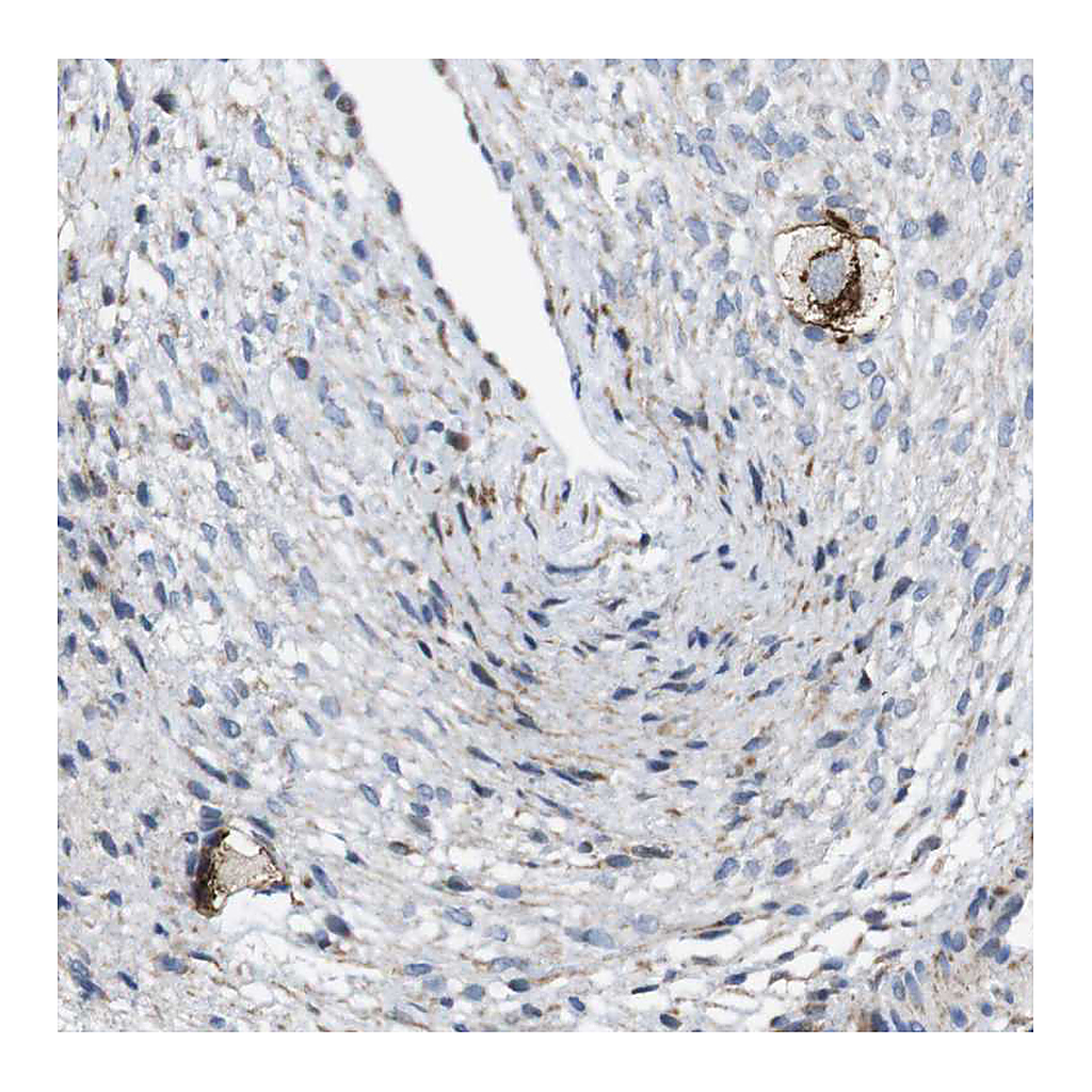 Atlas Antibodies Anti-ZP2 Antibody