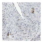 Atlas Antibodies Anti-ZP2 Antibody