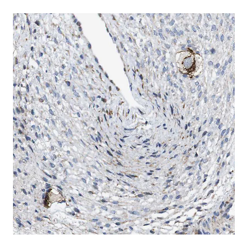 Atlas Antibodies Anti-ZP2 Antibody