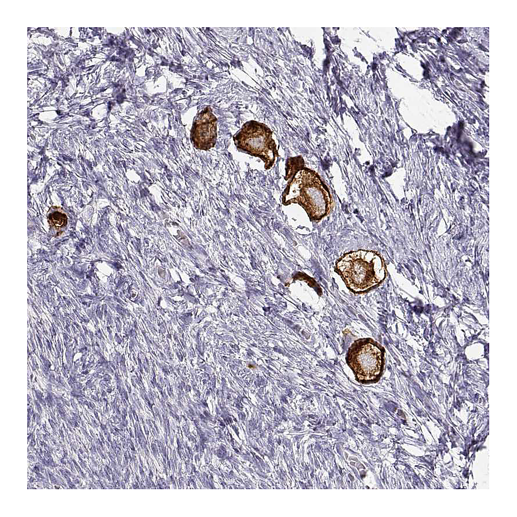 Atlas Antibodies Anti-ZP3 Antibody