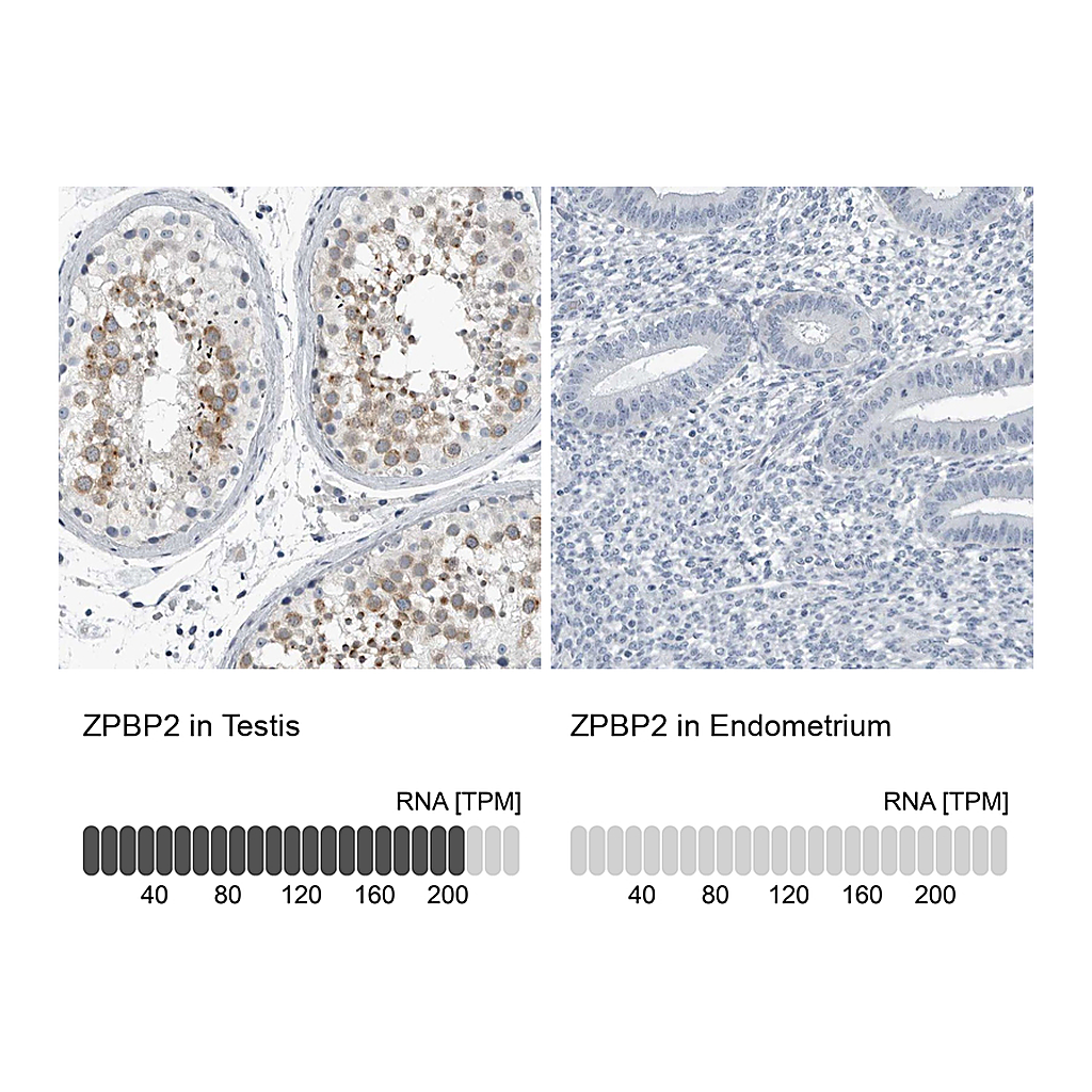 Atlas Antibodies Anti-ZPBP2 Antibody