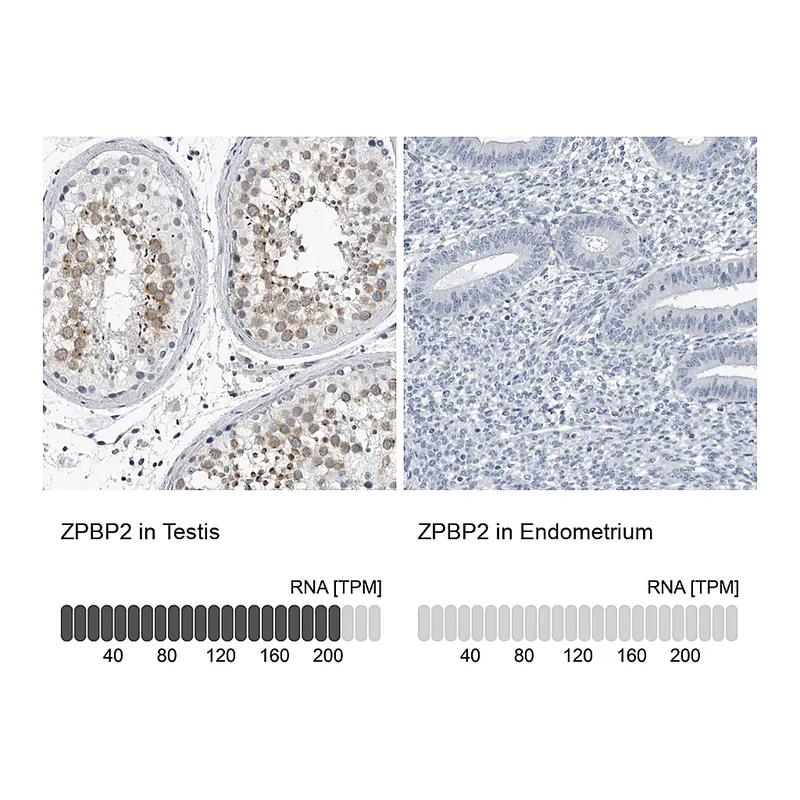 Atlas Antibodies Anti-ZPBP2 Antibody