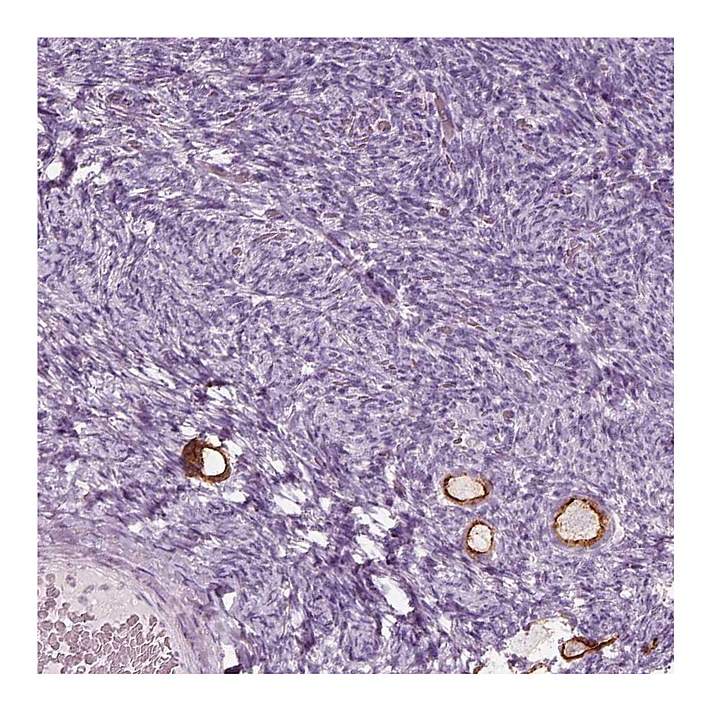 Atlas Antibodies Anti-ZP4 Antibody