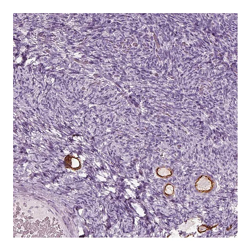 Atlas Antibodies Anti-ZP4 Antibody