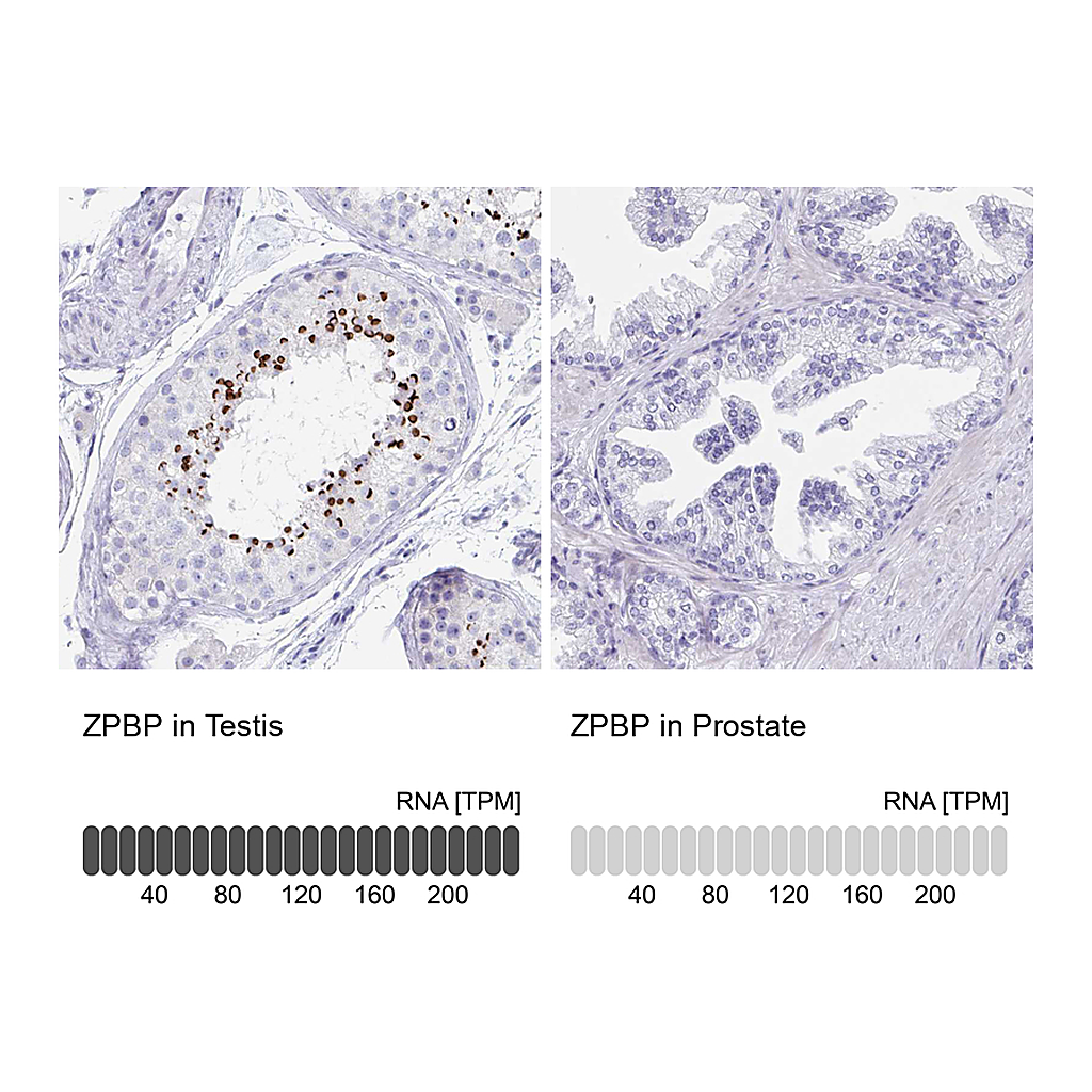 Atlas Antibodies Anti-ZPBP Antibody