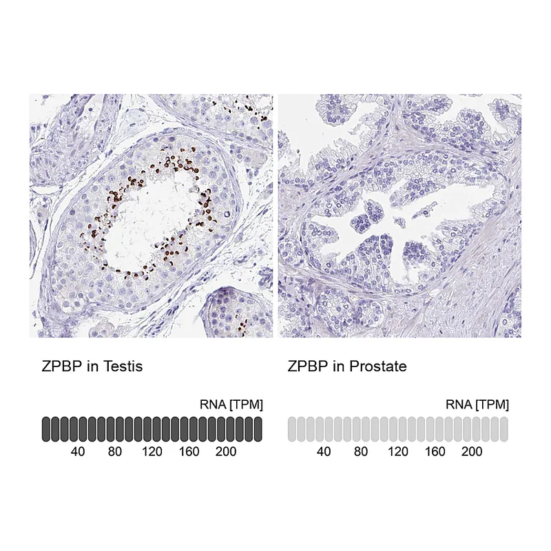Atlas Antibodies Anti-ZPBP Antibody