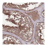 Atlas Antibodies Anti-ZPR1 Antibody