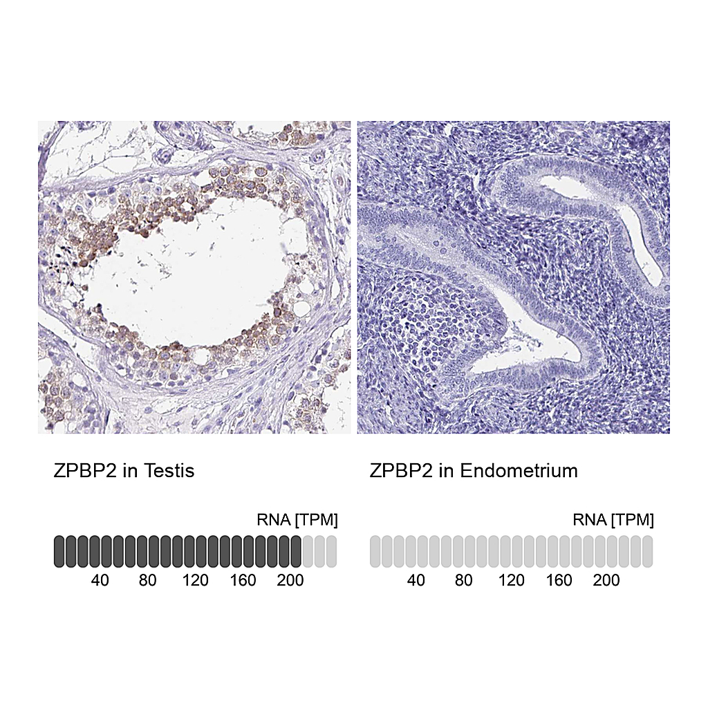Atlas Antibodies Anti-ZPBP2 Antibody