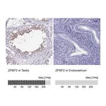 Atlas Antibodies Anti-ZPBP2 Antibody