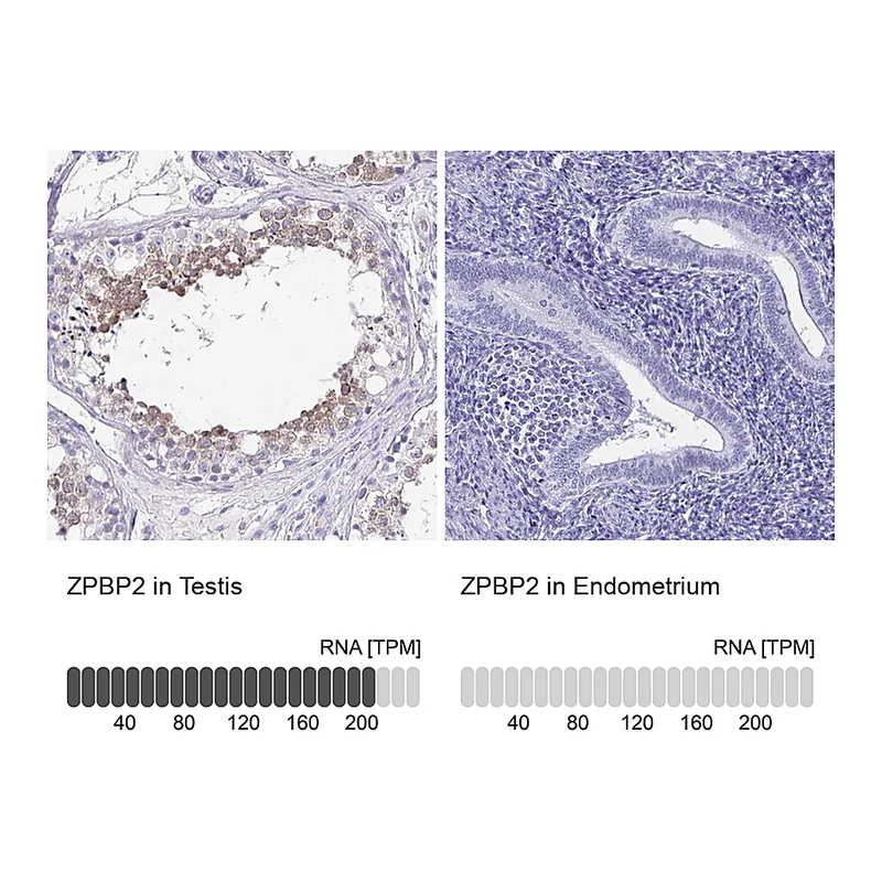 Atlas Antibodies Anti-ZPBP2 Antibody