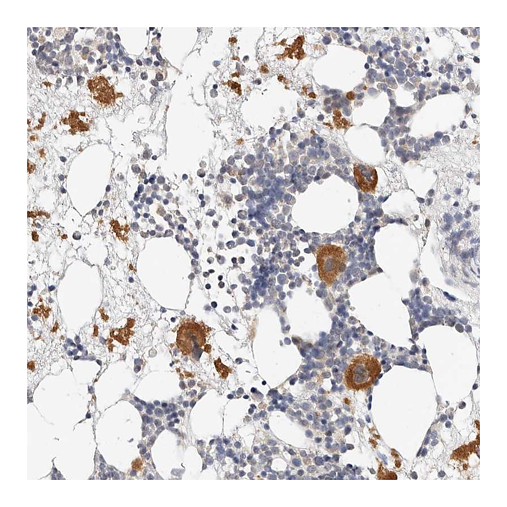 Atlas Antibodies Anti-ZRANB1 Antibody