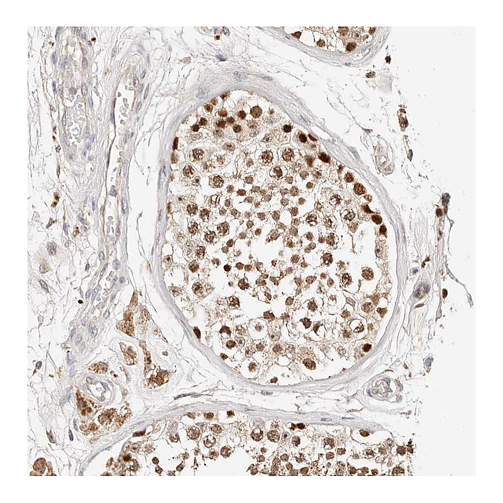 Atlas Antibodies Anti-ZRANB1 Antibody