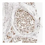 Atlas Antibodies Anti-ZRANB1 Antibody