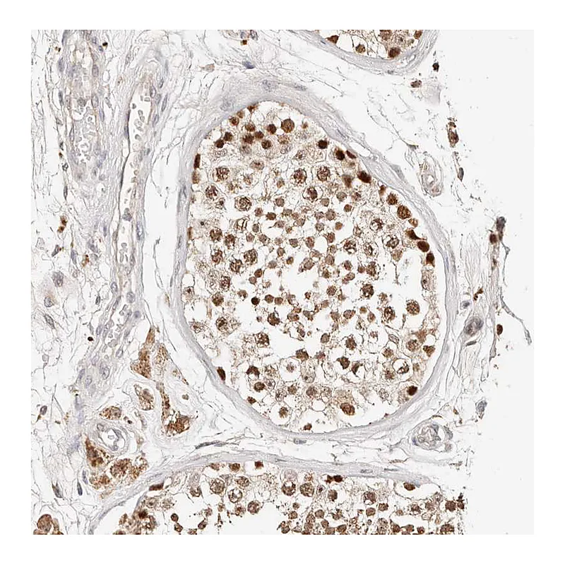 Atlas Antibodies Anti-ZRANB1 Antibody