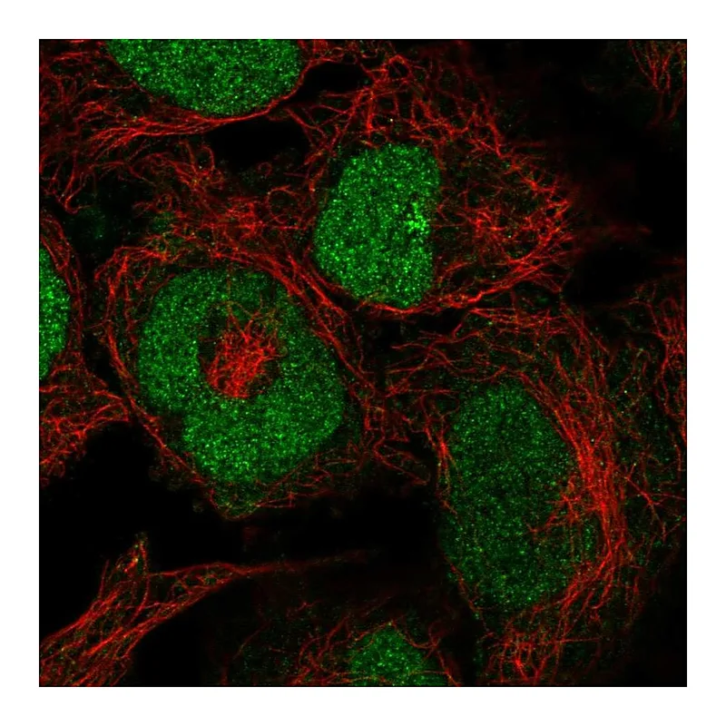 Atlas Antibodies Anti-ZRANB2 Antibody