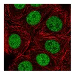 Atlas Antibodies Anti-ZRANB2 Antibody