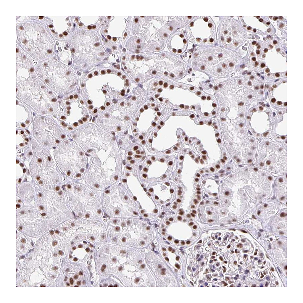 Atlas Antibodies Anti-ZRANB2 Antibody
