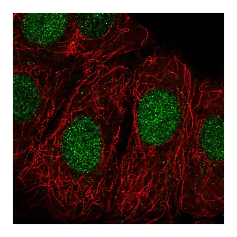 Atlas Antibodies Anti-ZRANB3 Antibody