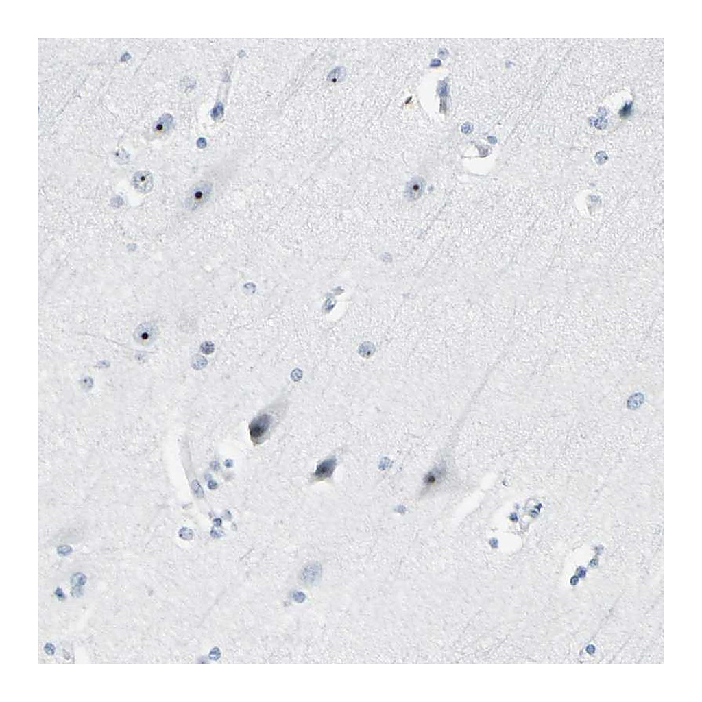 Atlas Antibodies Anti-ZSCAN1 Antibody
