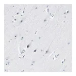 Atlas Antibodies Anti-ZSCAN1 Antibody