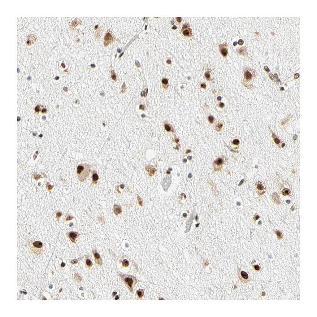 Atlas Antibodies Anti-ZSCAN16 Antibody