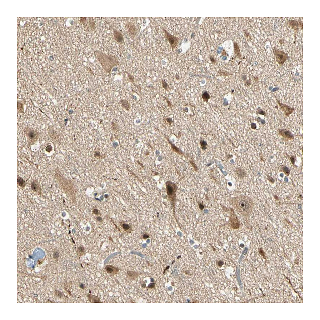 Atlas Antibodies Anti-ZSCAN12 Antibody