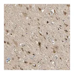 Atlas Antibodies Anti-ZSCAN12 Antibody