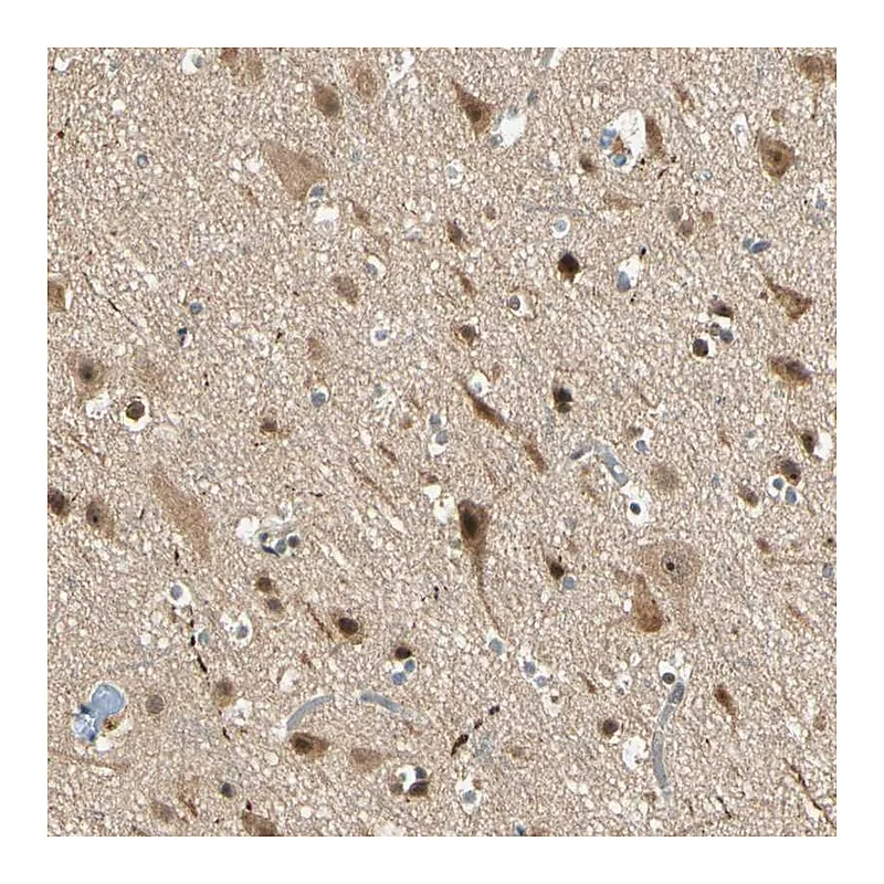 Atlas Antibodies Anti-ZSCAN12 Antibody