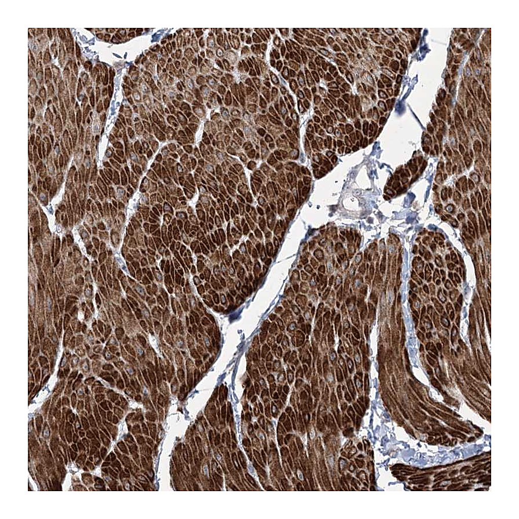 Atlas Antibodies Anti-ZSCAN23 Antibody