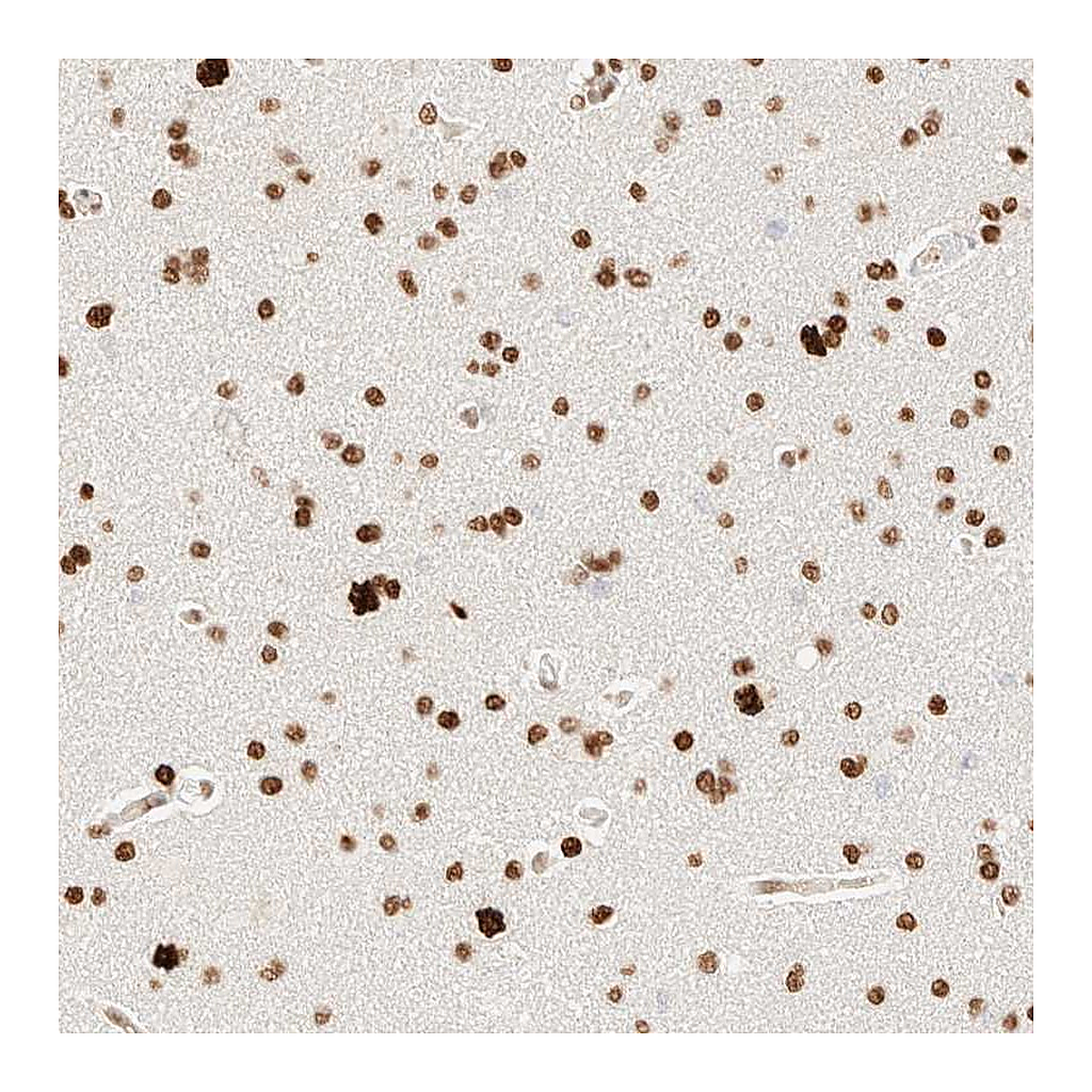 Atlas Antibodies Anti-ZSCAN18 Antibody