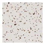 Atlas Antibodies Anti-ZSCAN18 Antibody
