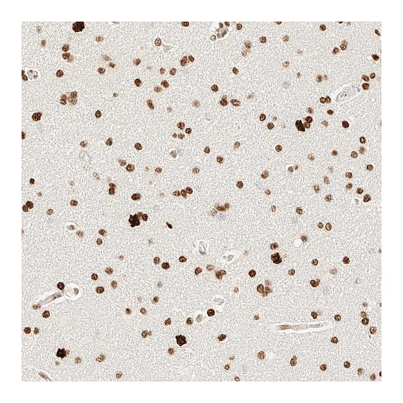 Atlas Antibodies Anti-ZSCAN18 Antibody