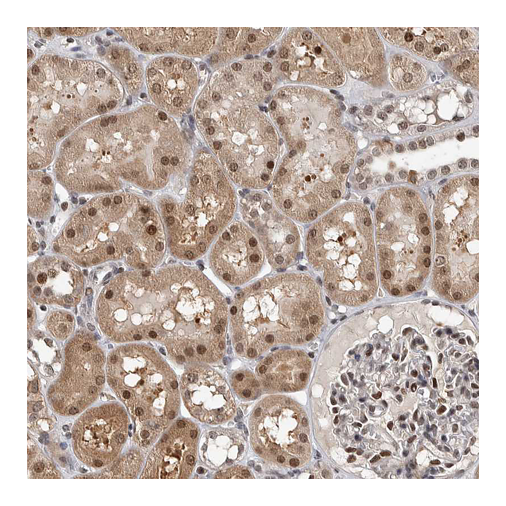 Atlas Antibodies Anti-ZSCAN21 Antibody