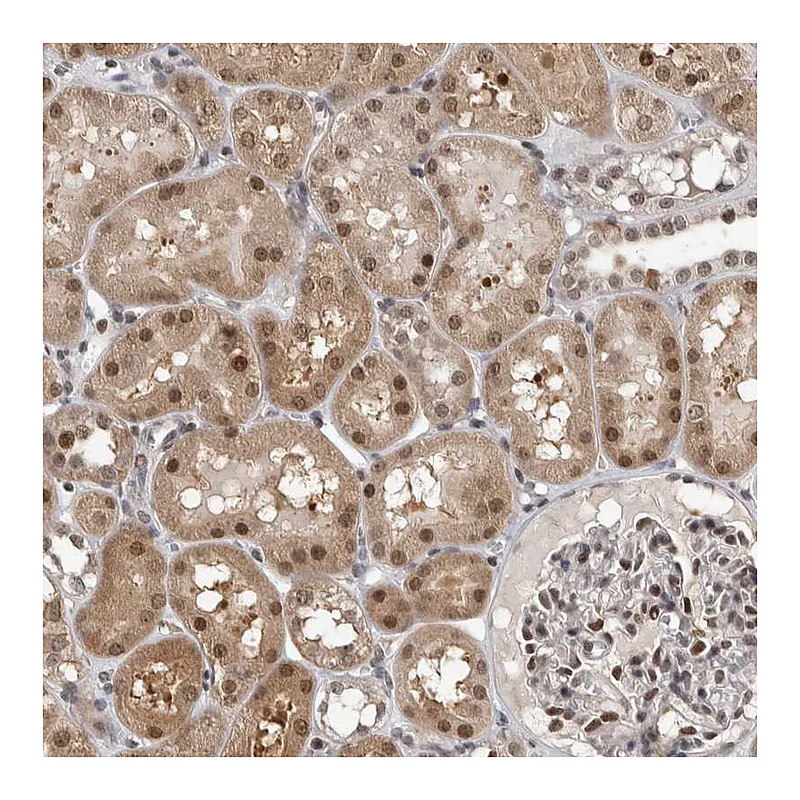 Atlas Antibodies Anti-ZSCAN21 Antibody