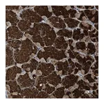 Atlas Antibodies Anti-ZSCAN22 Antibody