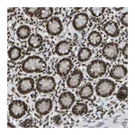 Atlas Antibodies Anti-ZSCAN20 Antibody