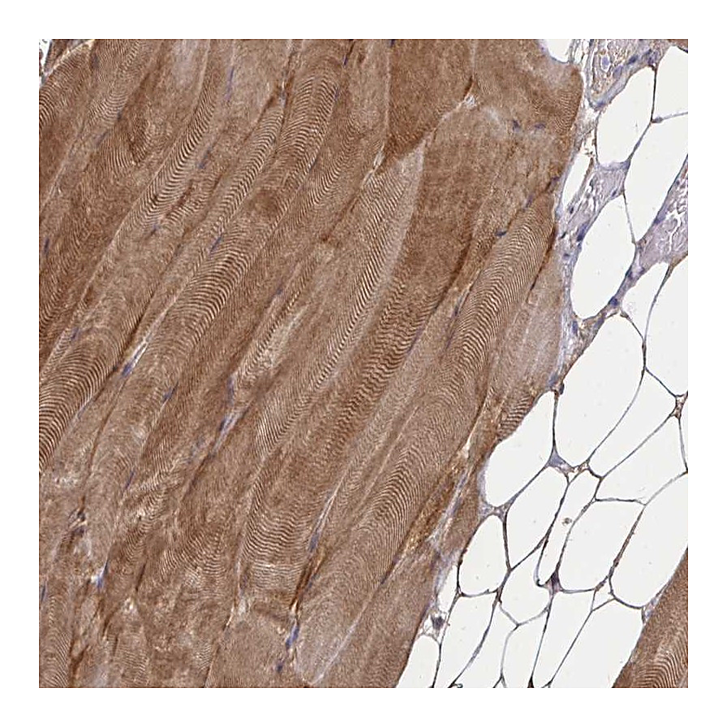 Atlas Antibodies Anti-ZSCAN25 Antibody