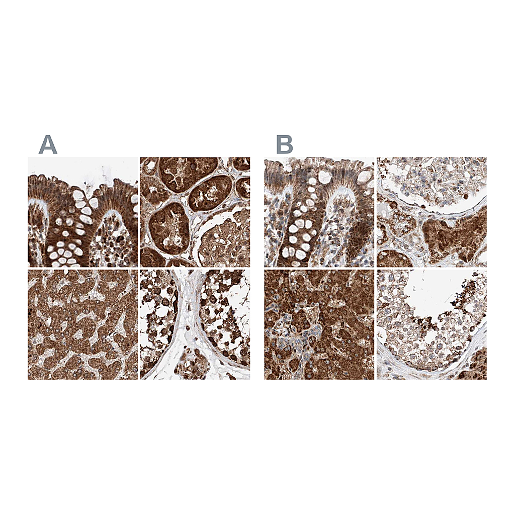 Atlas Antibodies Anti-ZSCAN29 Antibody