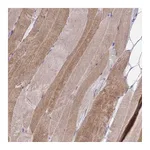 Atlas Antibodies Anti-ZSCAN25 Antibody