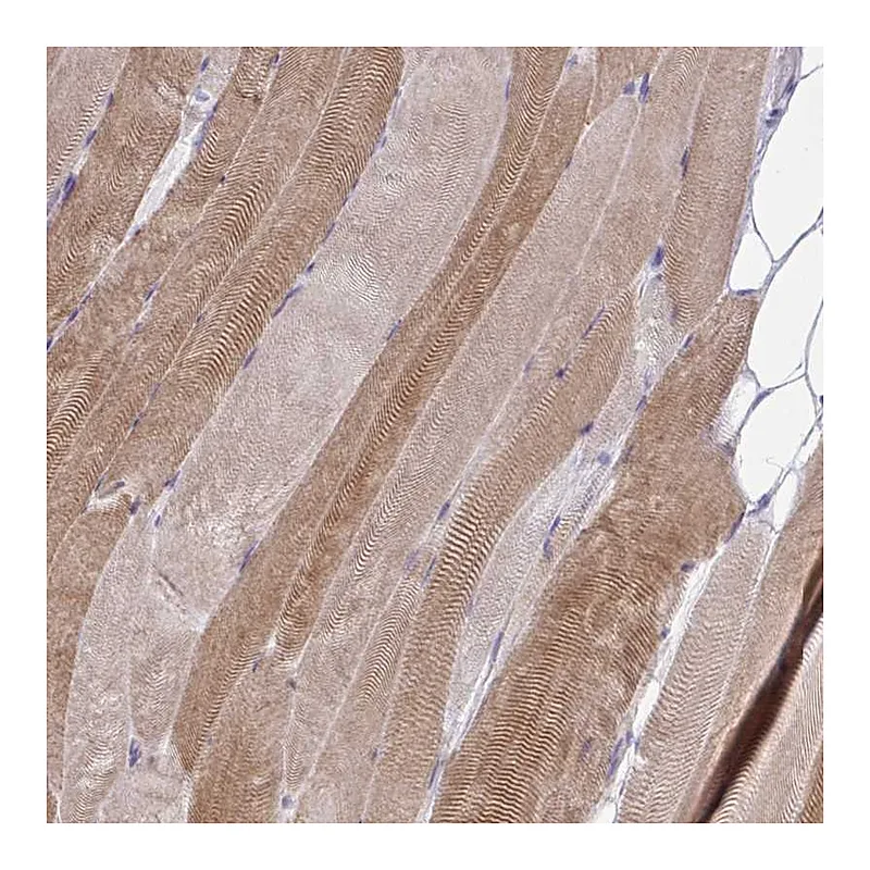 Atlas Antibodies Anti-ZSCAN25 Antibody