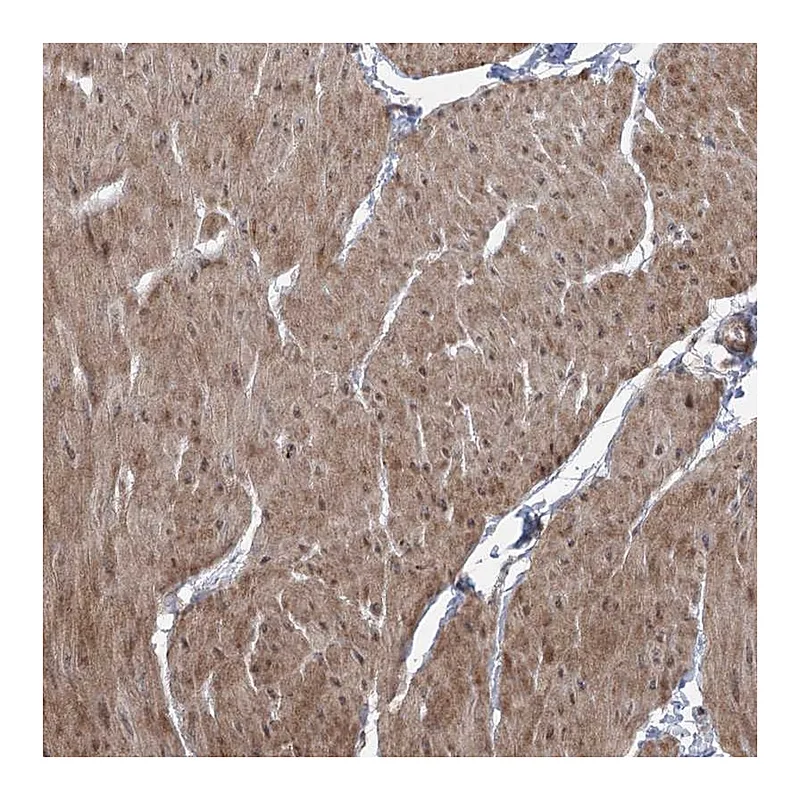 Atlas Antibodies Anti-ZSCAN23 Antibody